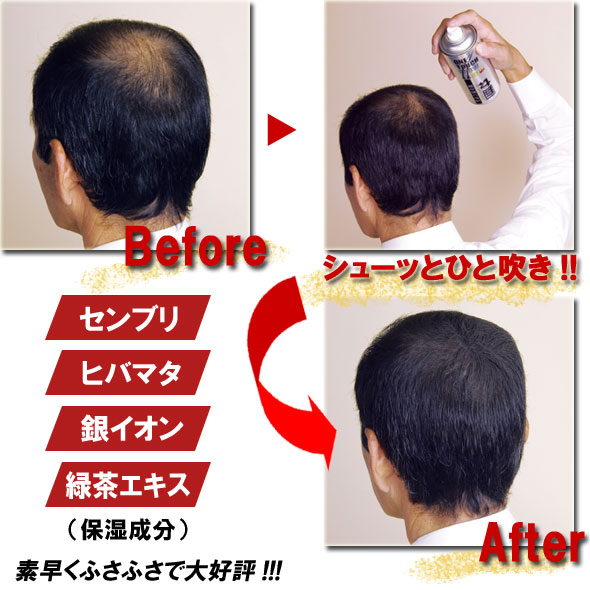 瞬間増毛スプレー【送料無料特別セットを追加発売】ワンタッチグローＥＸ